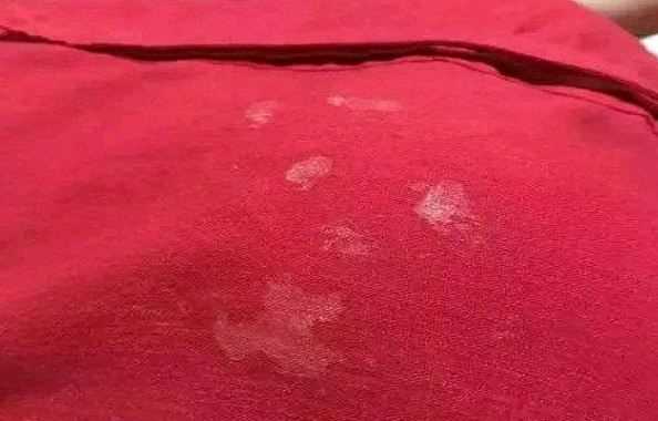 結(jié)構(gòu)膠粘衣服上用什么能洗掉,結(jié)構(gòu)膠怎樣清除在衣服上圖2