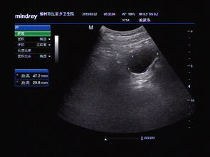 人流最快的恢復方法有哪些