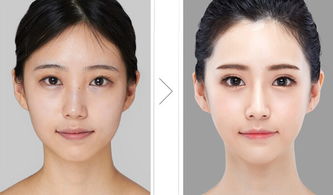 常見的臉部整形方法有哪些