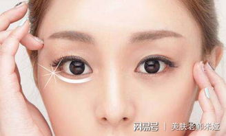 去快速眼袋的小方法有哪些