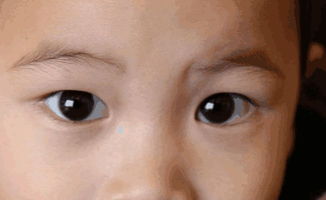 測(cè)斜視的方法有哪些