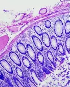 組織常用固定方法有哪些