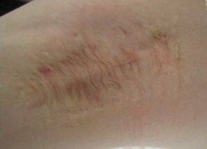 關(guān)于狐臭的詩(shī)句