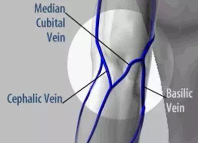 采集靜脈血的注意事項,采動脈血的注意事項,靜脈血的注意事項
