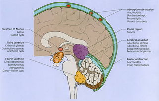 腦水腫觀察的注意事項