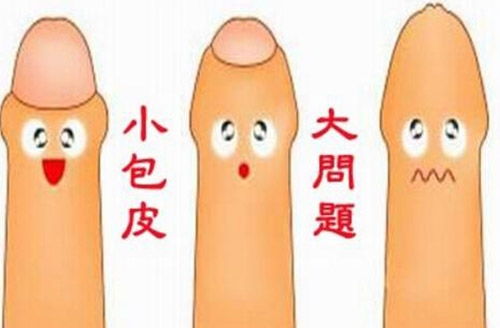 注意事項(xiàng),有哪些,割包皮