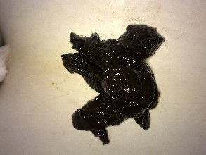 大便黑色注意事項(xiàng)