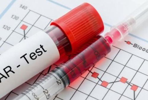 血糖,注意事項(xiàng),檢測,快速