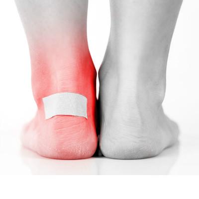 腳背,骨折,注意事項