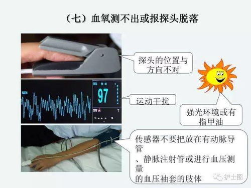 監(jiān)護(hù),注意事項(xiàng),心電