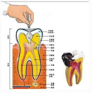 注意事項(xiàng),治療,有哪些