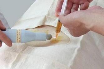 刃針療法后的注意事項(xiàng),做完浮針療法后注意事項(xiàng),小寬針療法后注意事項(xiàng)