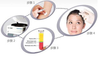 注射自體美容PRP后的注意事項