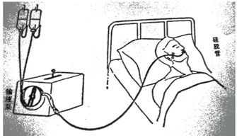 鼻飼,昏迷,注意事項(xiàng),患者