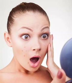 青春痘,去除,注意事項(xiàng)