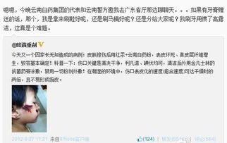 云南白藥使用方法和注意事項(xiàng),云南白藥噴霧劑注意事項(xiàng),云南白藥金戈注意事項(xiàng)