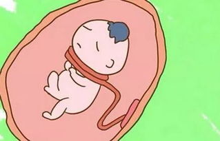 臍帶,孕婦,注意事項(xiàng)