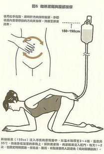 做完灌腸后注意事項(xiàng)