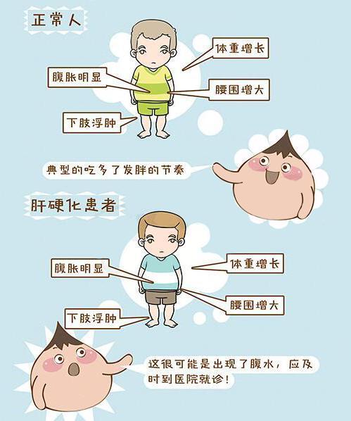 肝硬化患者飲食原則及注意事項,肝硬化晚期患者飲食注意事項,乙肝肝硬化患者飲食注意事項