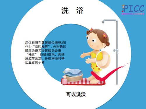 picc置管時的注意事項(xiàng)