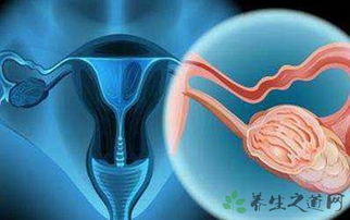 發(fā)生性關(guān)系有什么注意事項