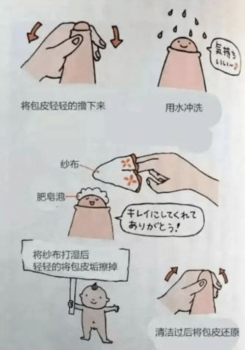 男生割包皮后注意事項