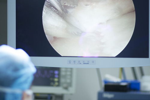 鰓裂囊腫注意事項