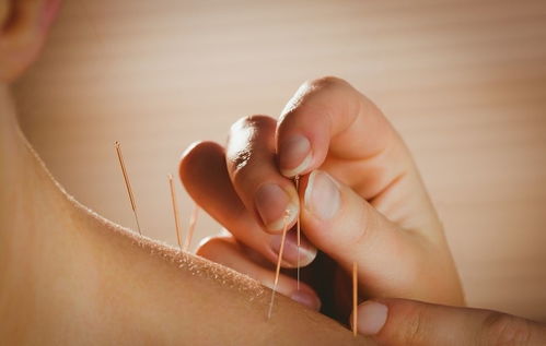 針灸翳風注意事項