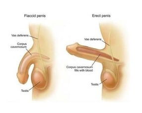 長(zhǎng)沙的陰莖延長(zhǎng)術(shù)日常注意事項(xiàng)有