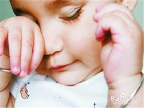 新生兒,注意事項(xiàng),眼睛