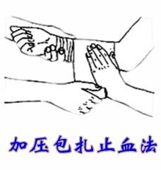 包扎止血法的注意事項(xiàng)