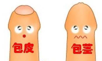 小孩包皮后注意事項(xiàng)