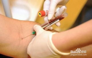 抽血驗(yàn)過敏源注意事項(xiàng)