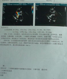 注意事項(xiàng),機(jī)械