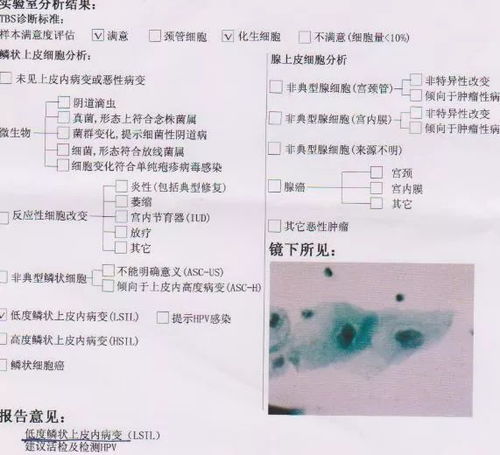 標(biāo)本,注意事項(xiàng),TCT