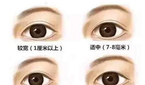 割雙眼皮睡覺注意事項