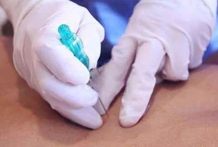 頸椎,注意事項(xiàng),埋線