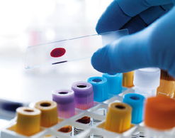 孕婦,注意事項(xiàng),測(cè)試