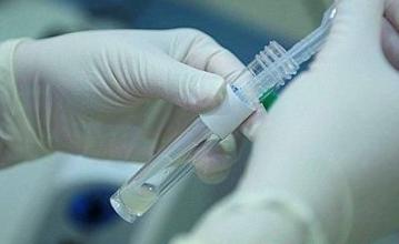 檢測精子前注意事項