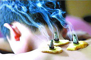 三伏灸的注意事項(xiàng),三伏灸注意事項(xiàng)和不良反應(yīng),三伏三九貼的注意事項(xiàng)