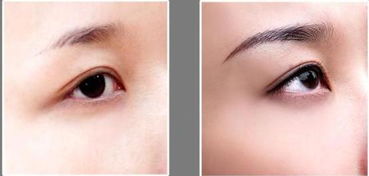 做眉毛之后注意事項(xiàng)