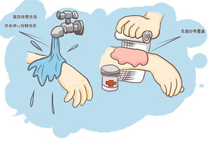 手燙傷之后注意事項(xiàng),包扎的注意事項(xiàng),簡述包扎的注意事項(xiàng)?