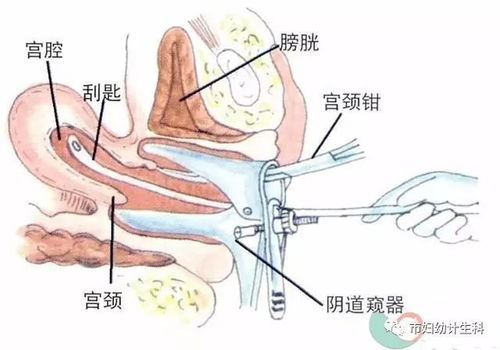 做無(wú)痛人流前需要注意什么,做無(wú)痛人流手術(shù)前需要注意什么,無(wú)痛人流手術(shù)前注意事項(xiàng)有哪些