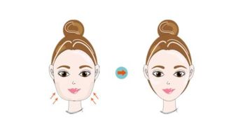 要注意,面部,抽脂,事項(xiàng)