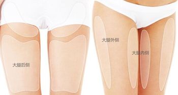 大腿內(nèi)側(cè)抽脂注意事項