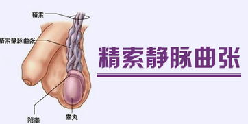 精索靜脈曲張手術(shù)后要注意什么,精索鞘膜積液手術(shù)后注意事項(xiàng),精索手術(shù)術(shù)后注意事項(xiàng)