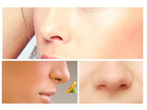整鼻子術(shù)后注意事項(xiàng),鼻子手術(shù)后注意事項(xiàng),整完鼻子注意事項(xiàng)