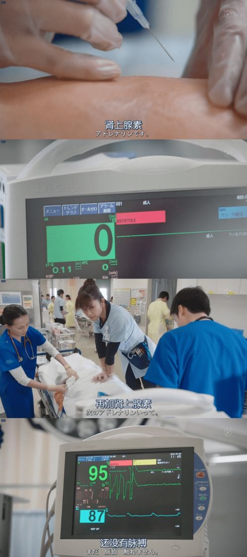 過敏性休克腎上腺素使用注意事項(xiàng)