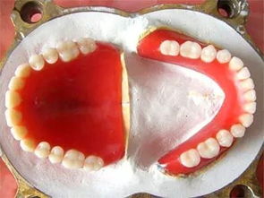 上頜,注意事項(xiàng)