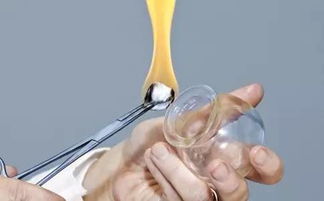 注意事項(xiàng),有哪些,拔罐